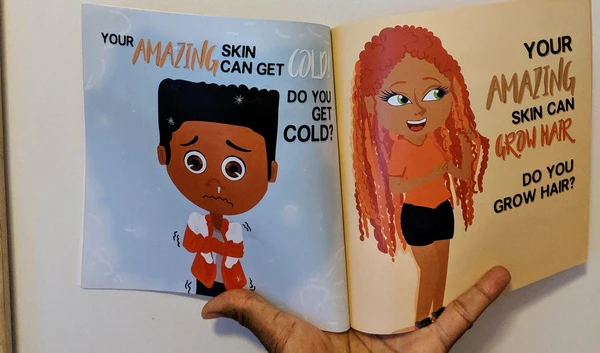 My Amazing Skin Can Heal: A Book About Boo-Boos, Bandages and Band Aids (Human Body For Kids) - Image 3